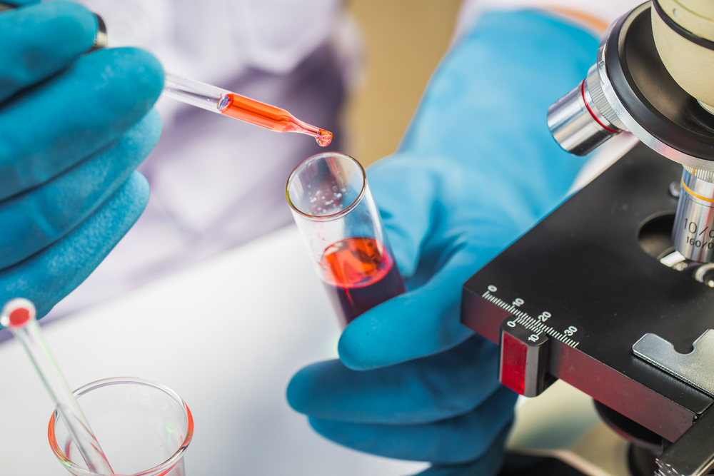 Hands of clinician holding tools during scientific experiment in laboratory