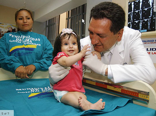 sitting child with fused legs