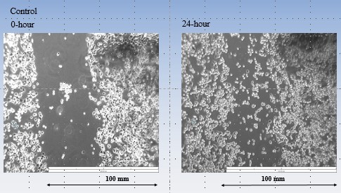 A Study on the Effects of Unfunctionalized-Single-Walled-Carbon-Nanotubes on Breast Cancer Cells Migration by Adkhamjon Soliev and Professor Regina Sullivan.